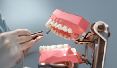 Who Should Get Dental Bridges?